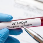 Teste rápido é decisivo na luta contra o coronavírus (covid-19)