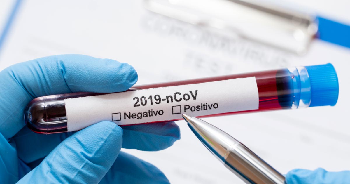 Teste rápido é decisivo na luta contra o coronavírus (covid-19)